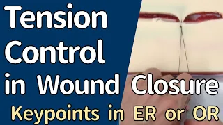 Knot Tying in Wound Closure - How to Adjust and Keep Suture Tension -