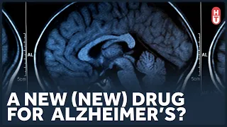 Some Good News in Alzheimer's Treatments