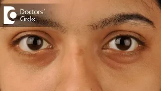 What causes Dark Circles under eyes? - Dr. Rasya Dixit