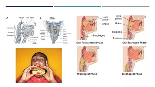 Myopahy and Dysphagia in Audlts with Cystinosis Dr  Sullivan and Dr  Grant