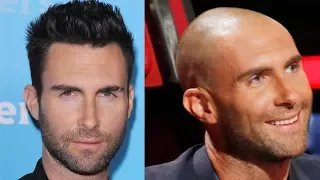 ✅Celebrity Hair Transplant Transformations! Why shaved head doesn´t suit everybody!