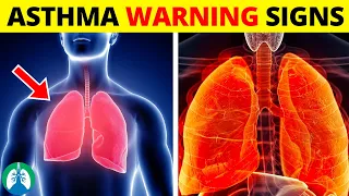 Top Early Warning Signs of Asthma *MUST KNOW* ⚠️