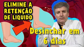 Descubra o Segredo: Como Detectar a Retenção de Líquidos em Dicas Surpreendentes!