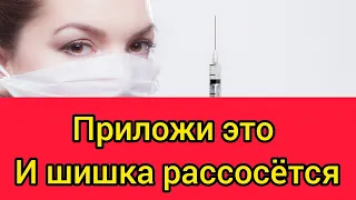 как БЫСТРО вылечить ШИШКИ после уколов// 2 самых эффективных способа