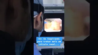 Cálculo Renal   Tratamento com laser