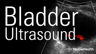 Basics of Bladder Ultrasound