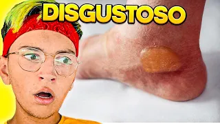 Questo video vi farà disgustare...