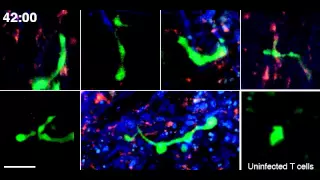 HIV infected cells in vivo