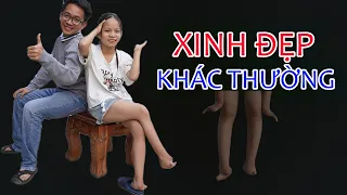 Cô nàng xinh đẹp, yêu đời với tay chân khác thường II ĐỘC LẠ BÌNH DƯƠNG