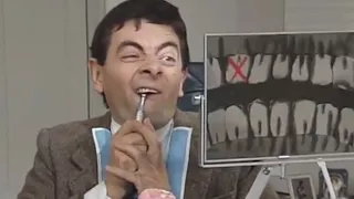 Dental Mental | Funny Clip | Classic Mr. Bean