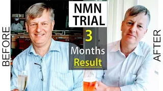 NMN and Resveratrol Trial : Our three months' progress
