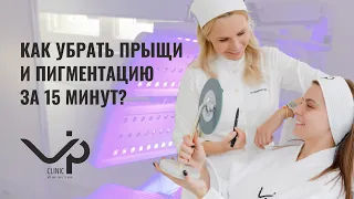 Как убрать прыщи за 15 минут HELEO4 M22 PICOSURE