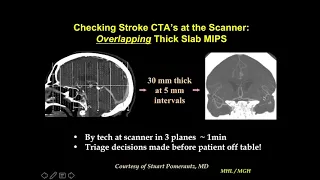 stroke imaging