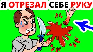 Мне пришлось отрезать свою левую руку, чтобы выжить...