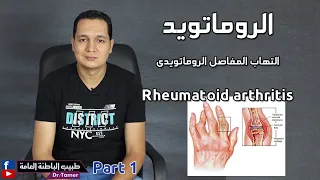 الروماتويد / الجزء الاول ( الاعراض والتشخيص والفحوصات) Rheumatoid arthritis