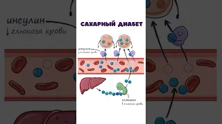 Сахарный Диабет - патогенез (инсулин, глюкагон биохимия)