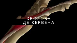 Хвороба де Кервена. Хірургія кисті.