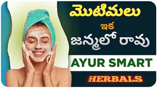 ||Ayur Smart ANTI PIMPLE Soap || పింపల్ ట్రీట్మెంట్ కోసం AYUR స్మార్ట్ హ్యాండ్ మేడ్ SOAP||