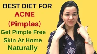 Best Diet For Acne(PIMPLES) Free Skin, Acne In Teenage(Puberty), How to Treat Acne Naturally at Home