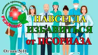 Псориаз. Псориаз кожи как лечить. Лечение тяжелых хронических заболеваний.