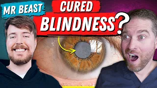 How MrBeast Helped Cure Blindness With Cataract Surgery