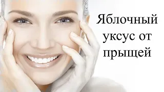 Яблочный уксус для лица.