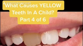 What cause yellow teeth in a child? (Part 4 of 6) 😱