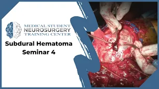 Subdural Hematoma Seminar 4