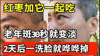 手上脸上都是斑？红枣加它一起吃，2天后一洗脸斑就哗哗往下掉！气色比20岁姑娘还好！【家庭大医生】