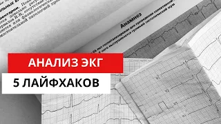 5 особенностей (лайфхаков) при АНАЛИЗЕ ЭКГ.