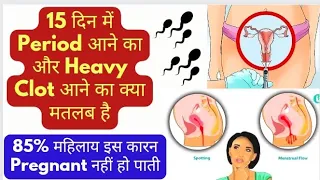 15 दिन में Period आने का और Clots आने का क्या मतलब है l 85% महिलाय इस कारन Pregnant नहीं हो पाती.