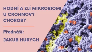 Hodní a zlí mikrobi u Crohnovy choroby (a jiných střevních onemocnění)