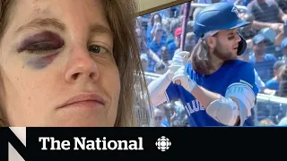 #TheMoment a Jays fan got love from team after taking a foul ball in the face