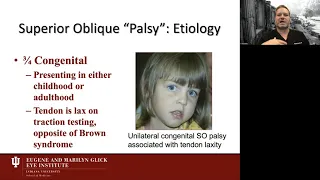 Lecture: Evaluation and Surgical Management of Superior Oblique Palsy: 2020 Update & Case Discussion