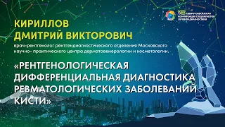 36  Рентгенологическая дифференциальная диагностика ревматологических заболеваний кисти   Кириллов Д