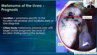 AANP Teaching Rounds - January 23, 2023 - Ocular Pathology: Uveal melanoma, Retinoblastoma, Cataract