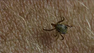 Florida woman's battle with late-stage neurological Lyme disease, how you can prevent getting it