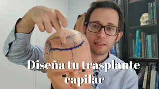 DISEÑA tu TRASPLANTE CAPILAR