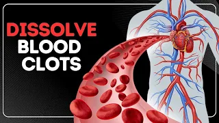6 Vitamins To DISSOLVE Your BLOOD CLOTS Immediately