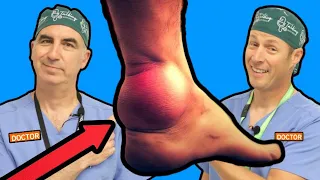 Achilles Tendinitis: Causes and Treatments