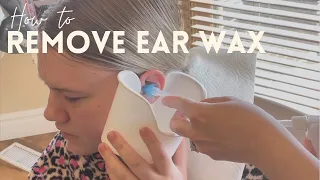Amazing Ear Wax Removal
