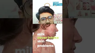 skin problems with milk intake || #skincare