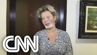 Polícia Civil descarta agressão contra Joice Hasselmann e aponta queda acidental | LIVE CNN