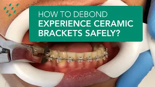 How to debond EXPERIENCE ceramic brackets safely?