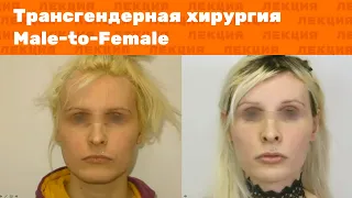 Лекция: Трансгендерная хирургия Male-to-Female. Феминизирующая пластика лица