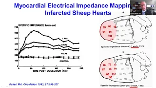 Biophysics of Pulsed Electrical Field Ablation