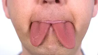Growing Two Tongues!