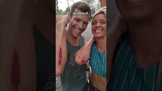 Scooter Crash in Bali