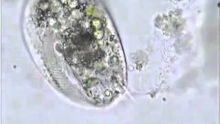 Микроскопические обитатели моря // 'Euplotes  жизнь длинною в день'   Microscopic marine creatures