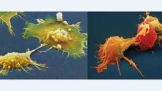 Иммунитет - это лактобацилы, микроскопический грибок. Гормональный и иммунный ужас!